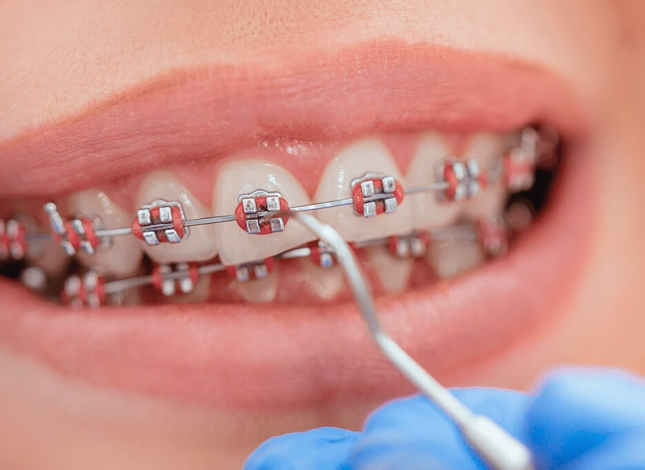Picture of Orthodontics