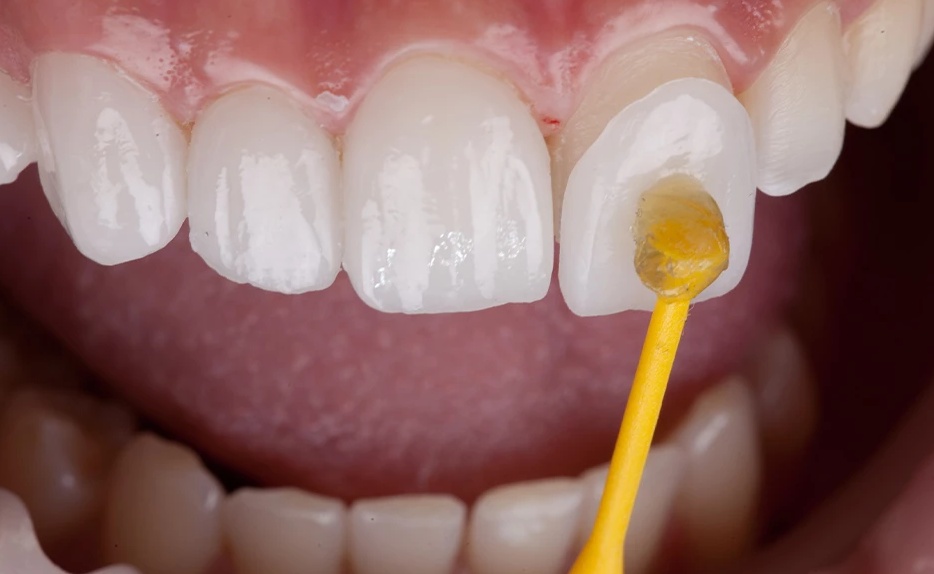 Picture of Prosthodontics